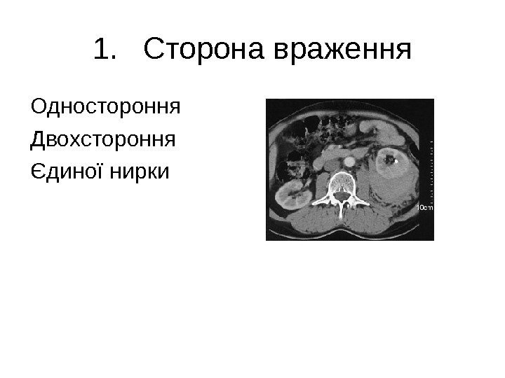   1. Сторона враження Одностороння Двохстороння Єдиної нирки 